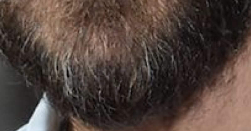 Raad de baard