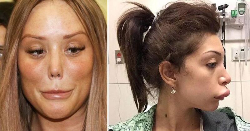 20 mensen die beter geen plastische chirurgie hadden kunnen doen
