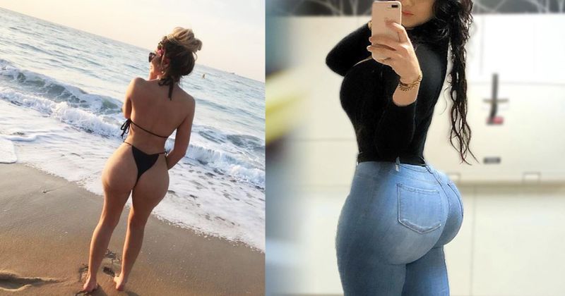 21 vet domme foto's van mensen die een nieuwe kont gekocht hebben